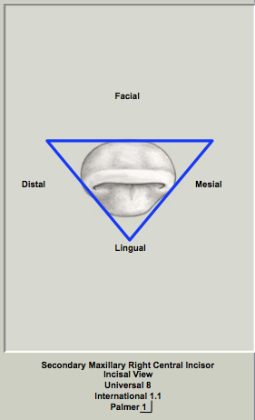 Ext Morph Mx Central Incisal 2.png